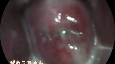 KR TWITTER PORN VIDEOS 00079809